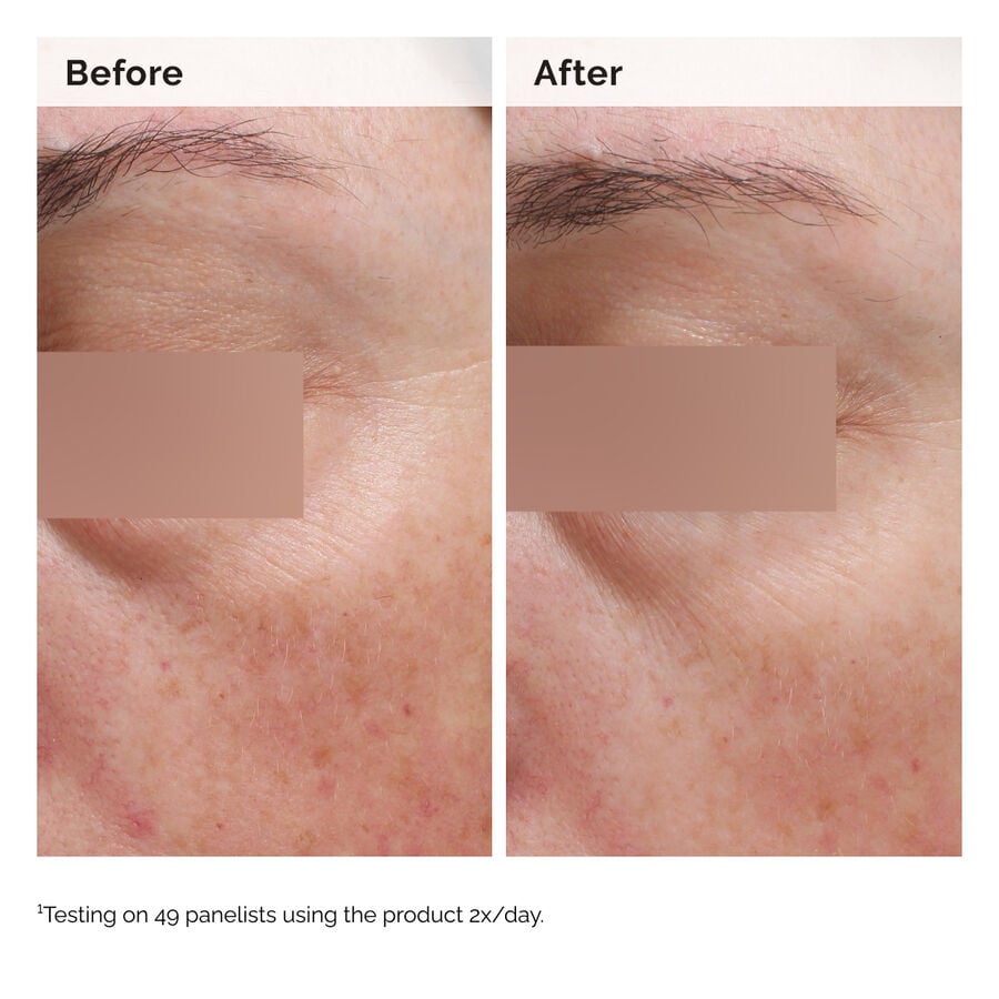 niacinamide-5-face-and-body-emulsion-l2 2024-08-23-ORD-Nia-5pct-Face-Body-B-A-Elasticity-Global-02-1x1.jpg