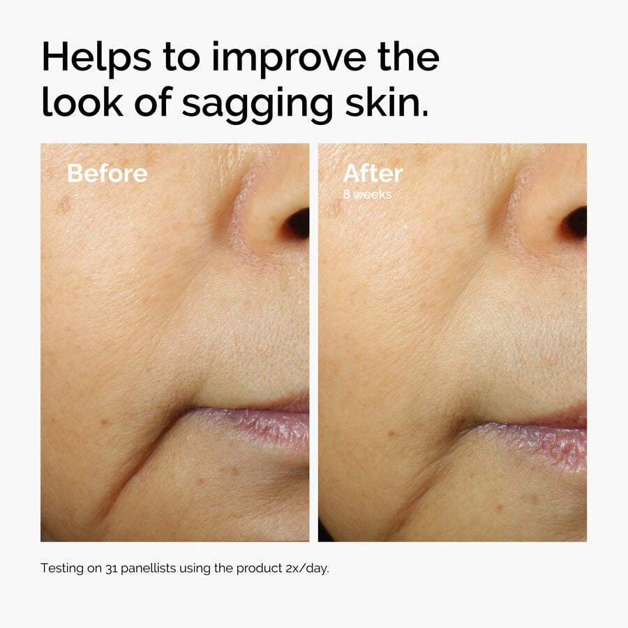 caffeine-3-escin-1-face-serum-v2 ord-caffeine-3pct-escin-1pct-face-serum-before-after-sagging.jpg