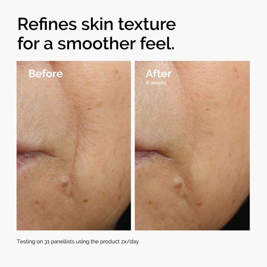 caffeine-3-escin-1-face-serum-v2 ord-caffeine-3pct-escin-1pct-face-serum-before-after-texture.jpg