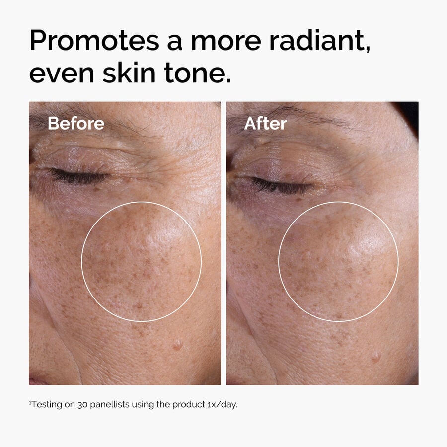glycolic-acid-7-exfoliating-toner-g6 ord-glycolic-before-after-radiance.jpg