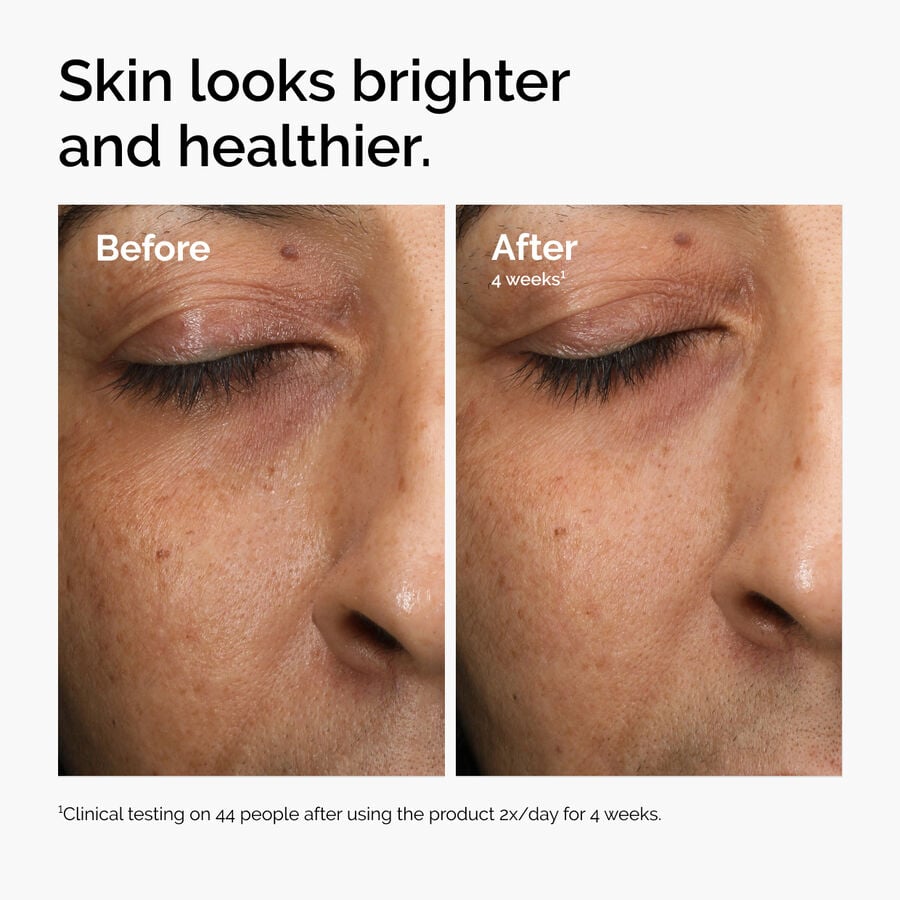 multi-antioxidant-radiance-serum-k5 ord-mars-before-after-healthy.jpg