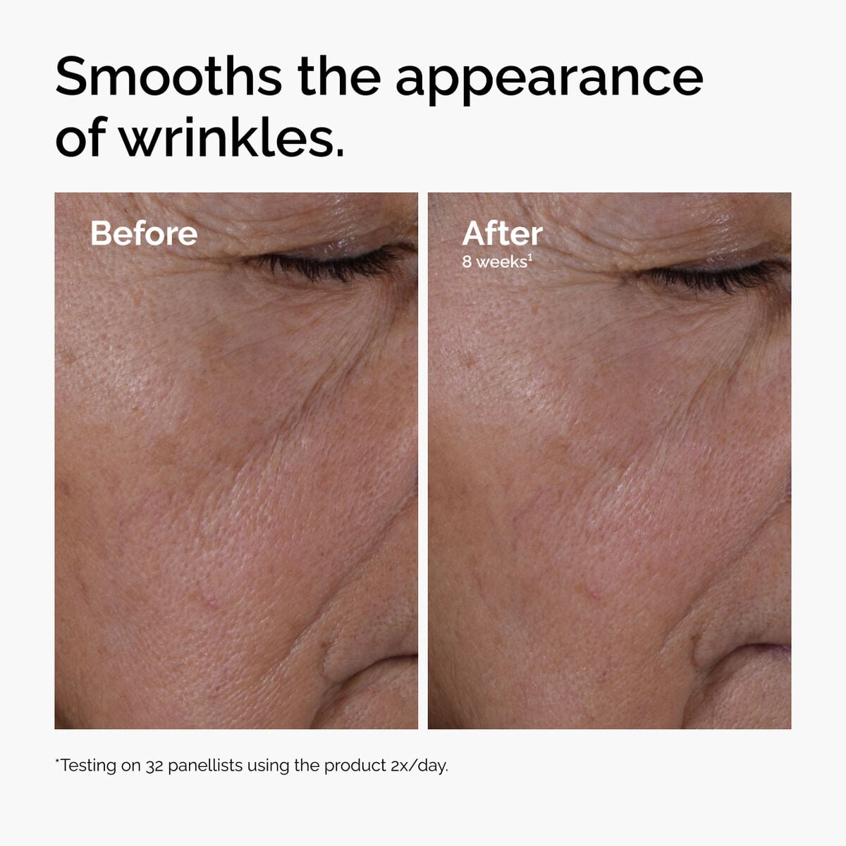 multi-peptide-ha-serum-u4 ord-multi-peptide-ha-serum-wrinkles-before-after.jpg