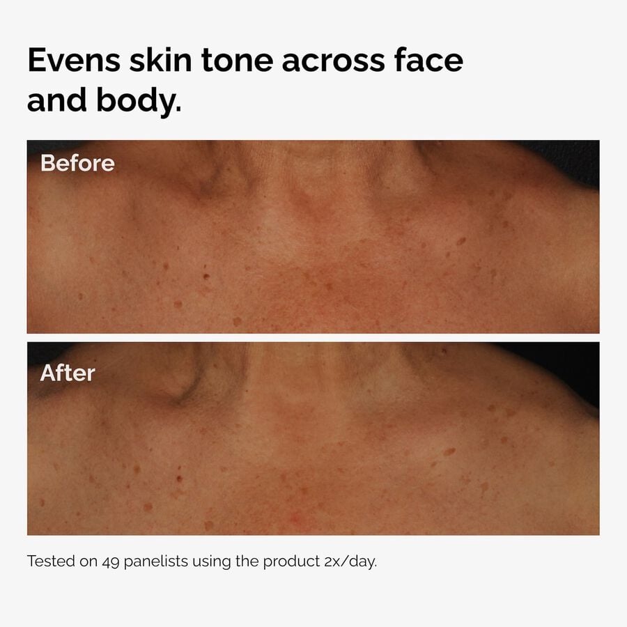 the-body-care-collection-v6 ord-niacinamide-face-body-serum-before-after-even-tone-graphic.jpg