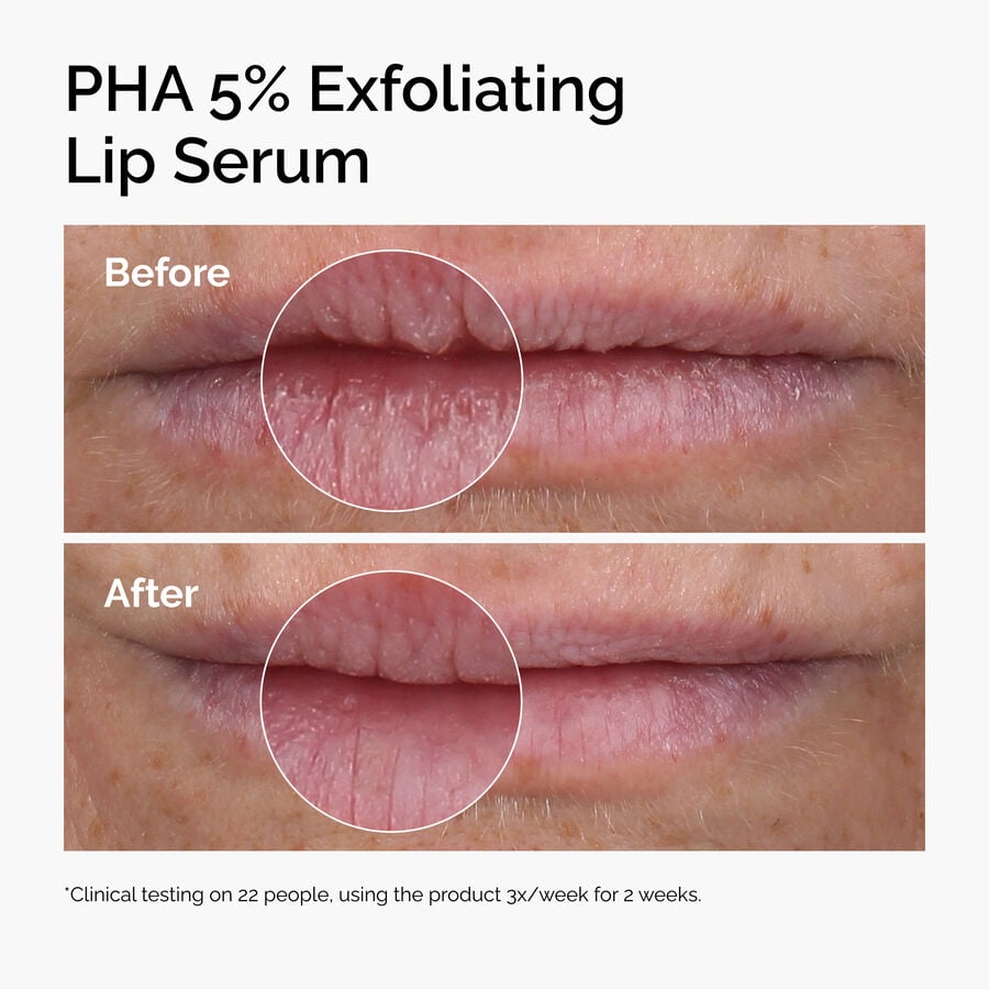 pha-5-exfoliating-lip-serum-r5 ord-pha-5pct-lip-exfoliating-serum-before-after.jpg